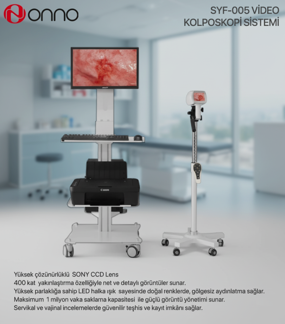 Onno SY-F005 Video Kolposkop Sistemi